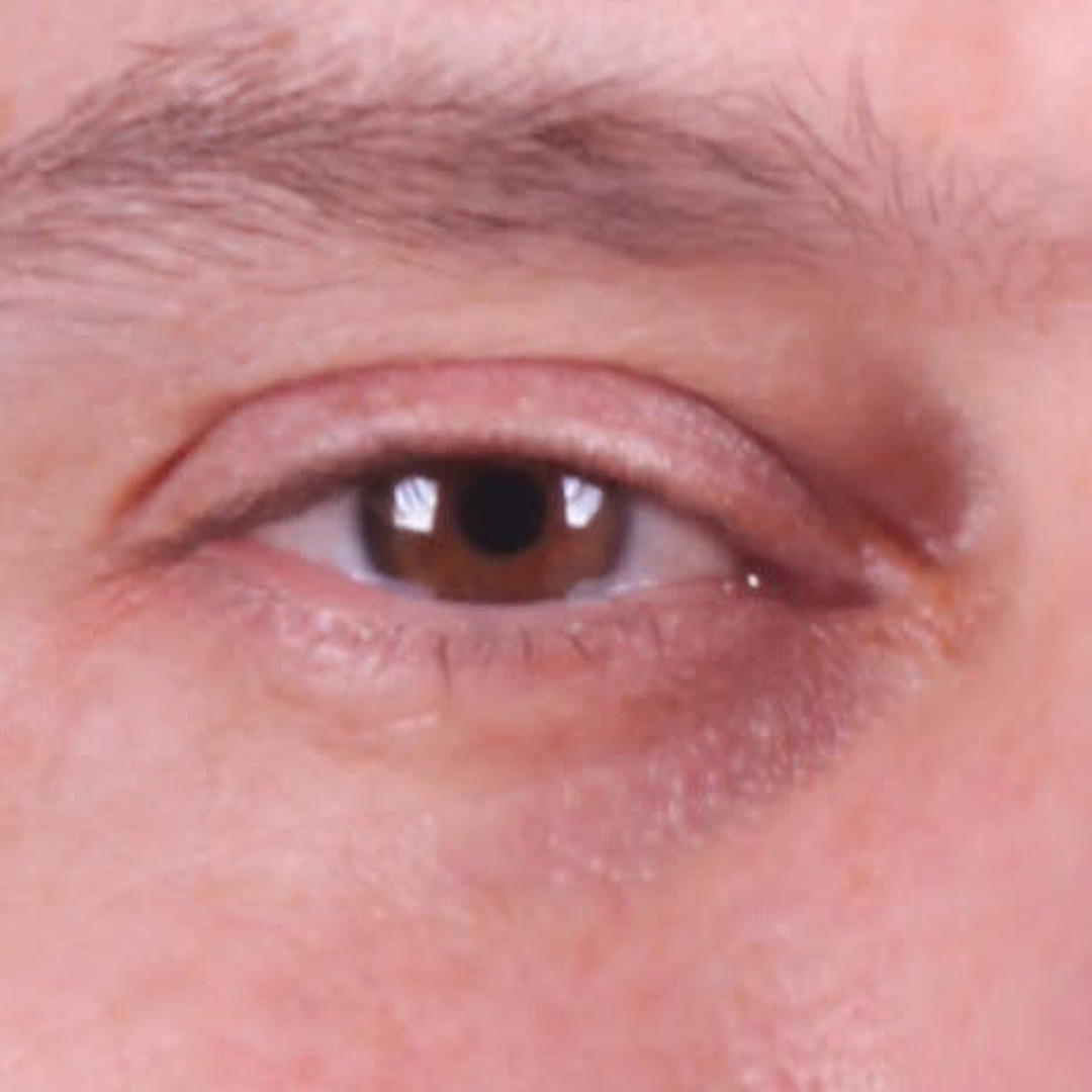 depois-5 depois-5